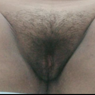 Ketum